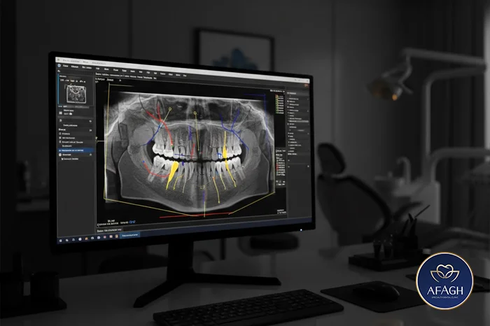 تصویربرداری CBCT برای ایمپلنت در الهیه تهران