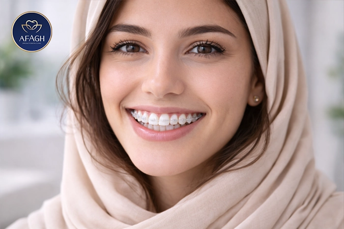 براکت سرامیکی همرنگ دندان در الهیه