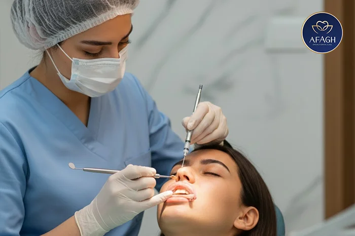 اجرای لایه‌گذاری کامپوزیت ونیر در الهیه تهران
