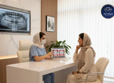 قیمت کامپوزیت ونیر در الهیه شمال تهران