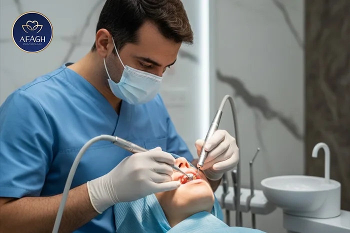 جراحی ایمپلنت دندان در الهیه تهران