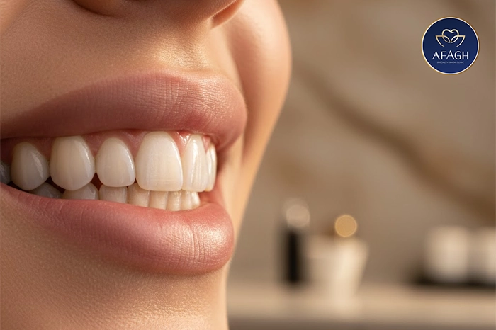 طراحی لبخند طبیعی در کلینیک دندانپزشکی منطقه ۱ تهران