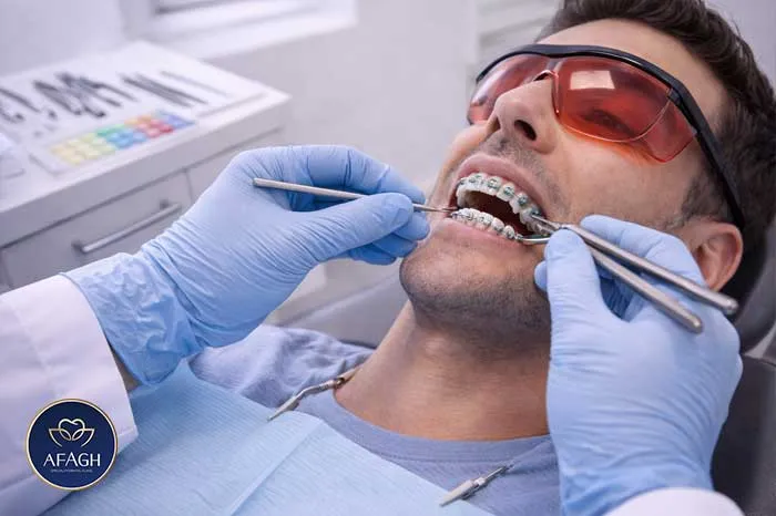 جلسه تنظیم دورهای ارتودنسی در فرشته