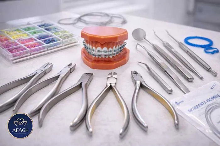 ابزار تخصصی ارتودنسی در کلینیک آفاق فرشته