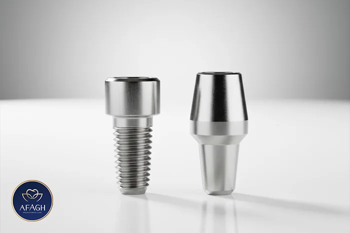 قطعات ایمپلنت دندان باکیفیت در الهیه تهران