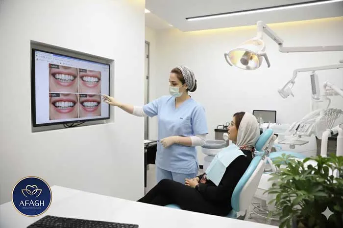 مشاوره طراحی لبخند برای لمینت و کامپوزیت در الهیه